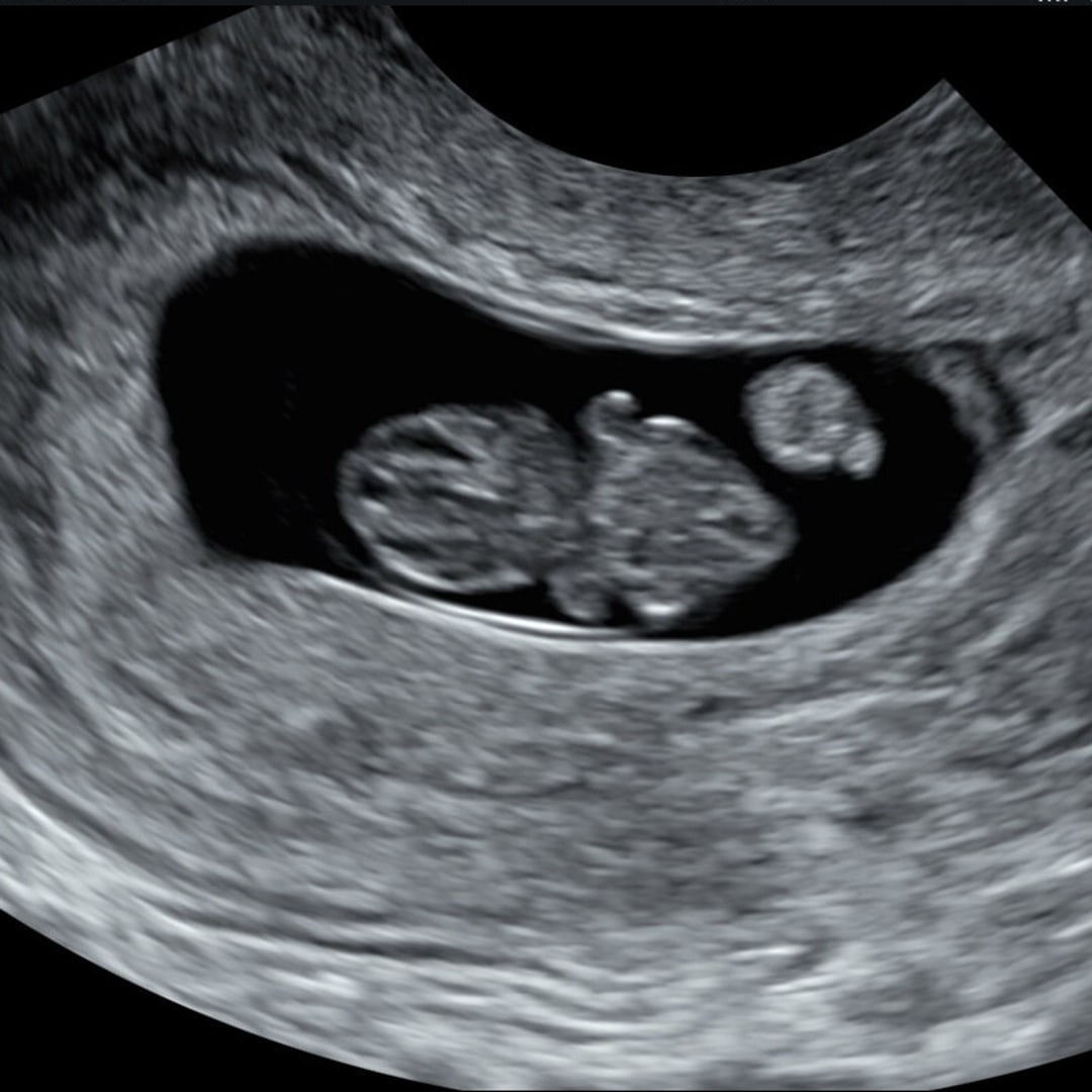 Photo shared by Cheyanne for their Babylist baby registry.