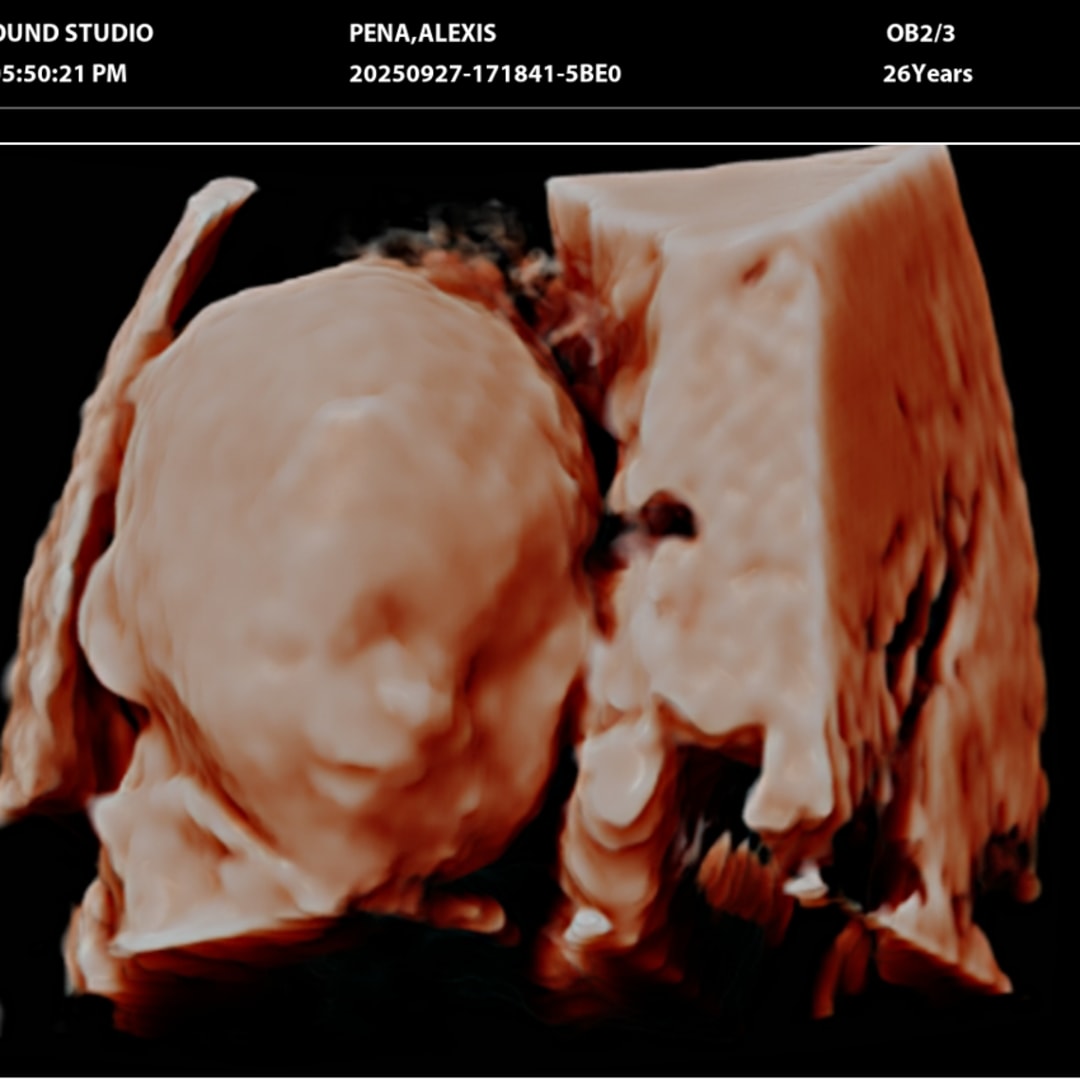 Photo shared by Alexis for their Babylist baby registry.