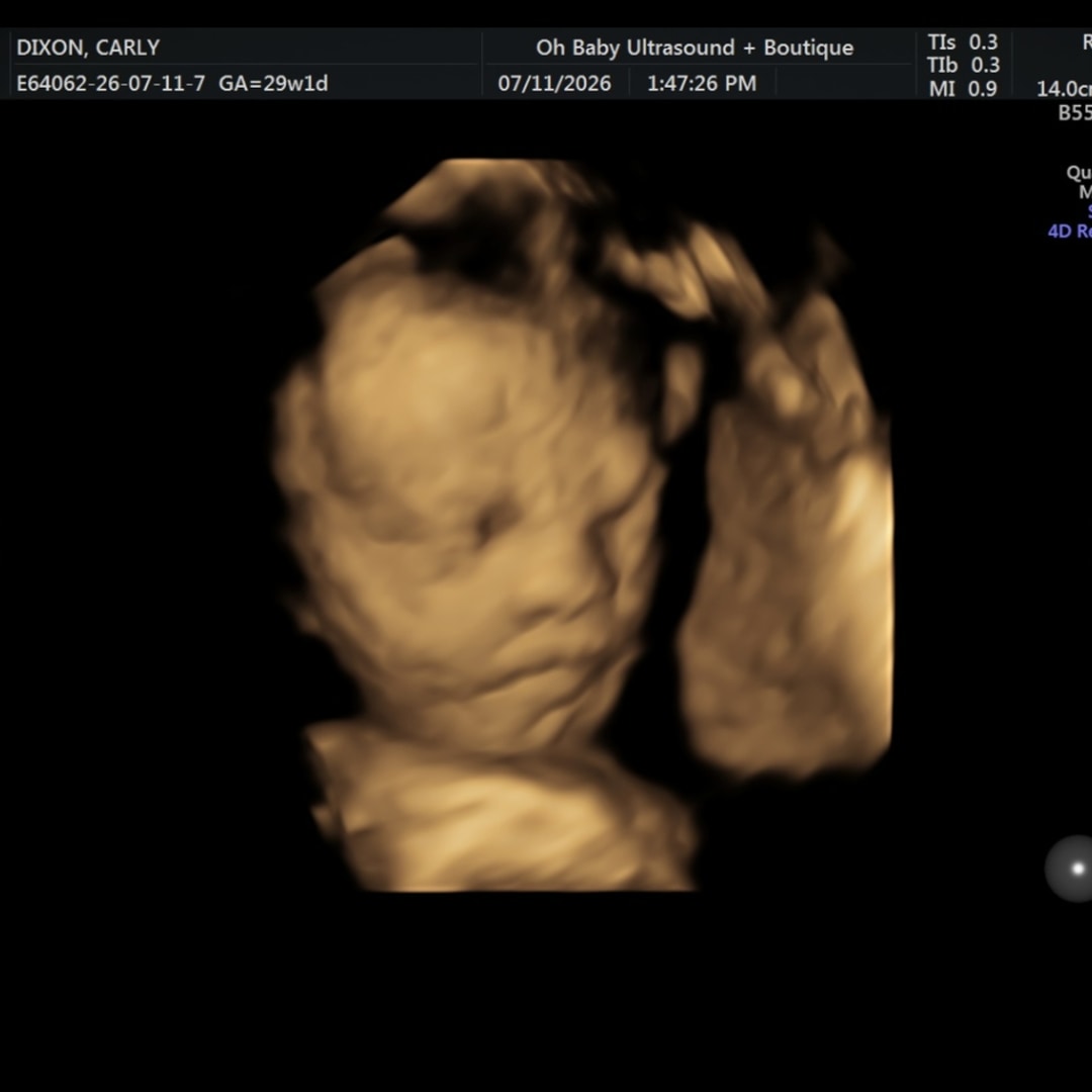 Photo shared by Carly for their Babylist baby registry.
