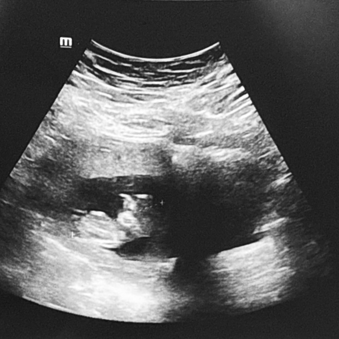 Photo shared by Stephanie for their Babylist baby registry.