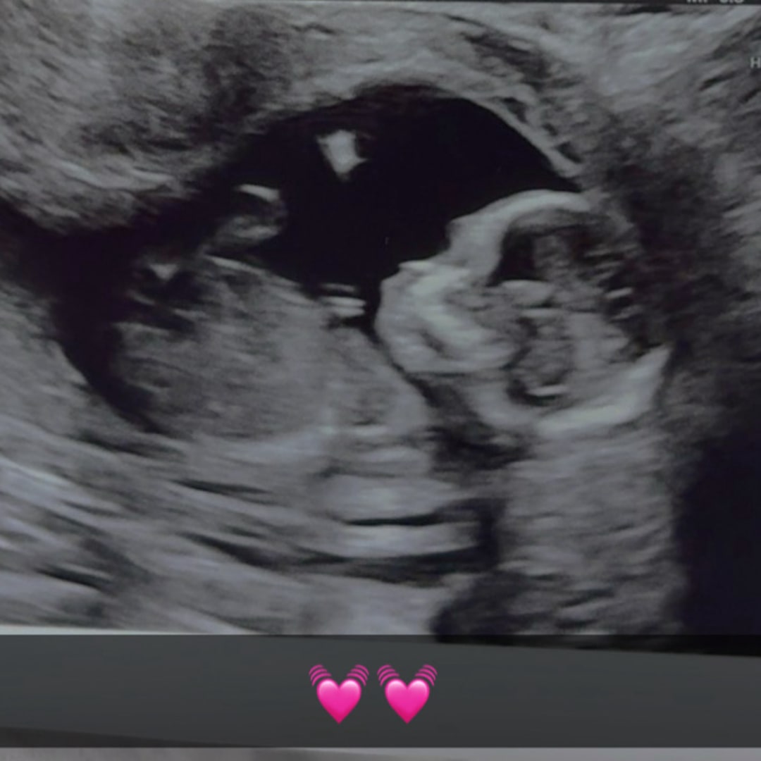Photo shared by Demyjah for their Babylist baby registry.