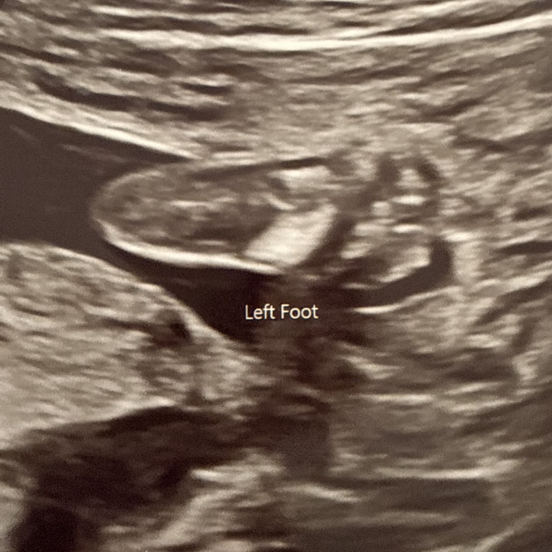 Photo shared by Jamie for their Babylist baby registry.