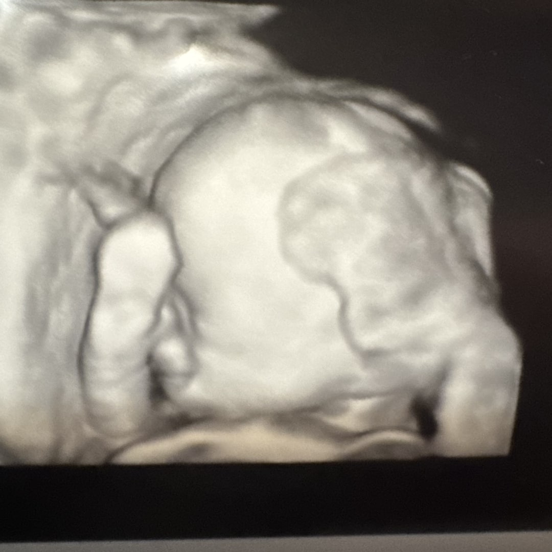 Photo shared by Georgia for their Babylist baby registry.