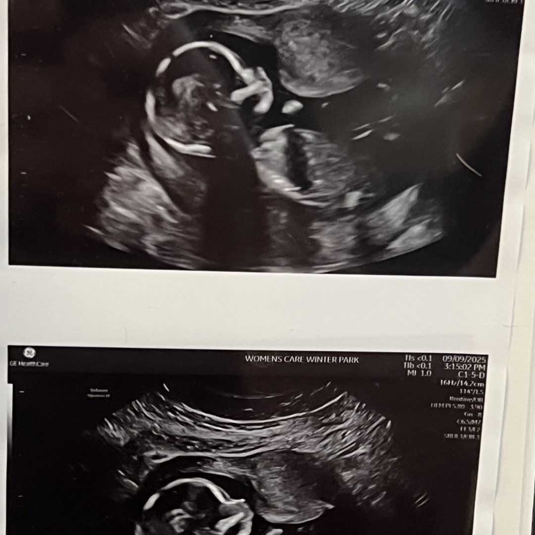 Photo shared by Caitlen for their Babylist baby registry.