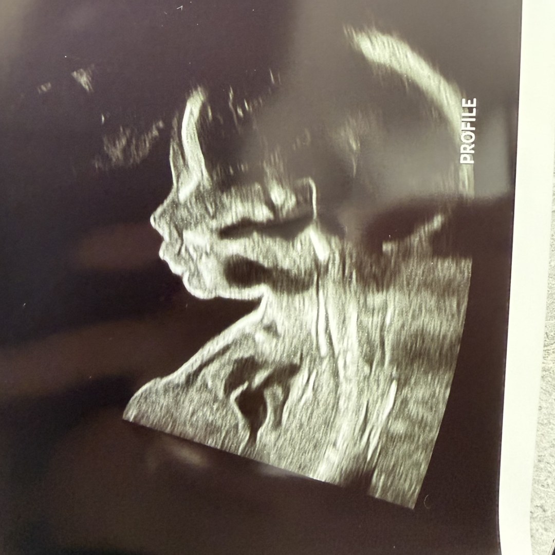Photo shared by Melissa for their Babylist baby registry.
