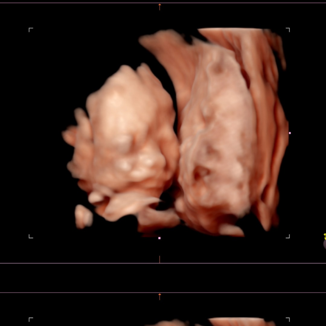 Photo shared by Emily for their Babylist baby registry.