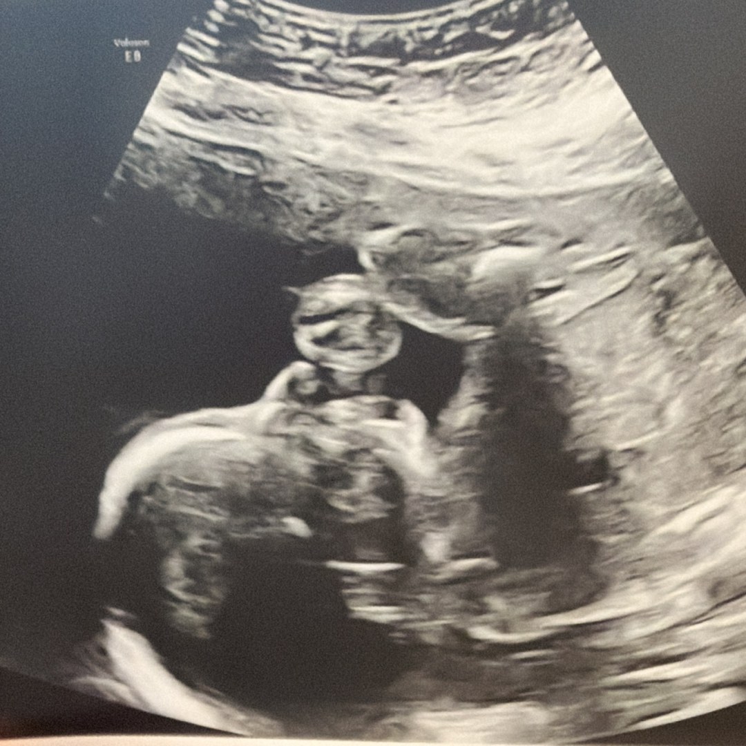 Photo shared by Nunzia for their Babylist baby registry.
