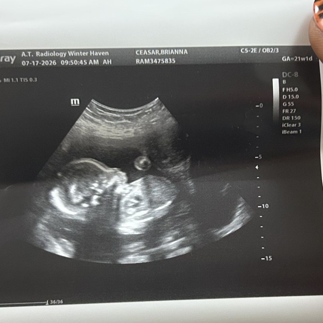 Photo shared by Brianna for their Babylist baby registry.
