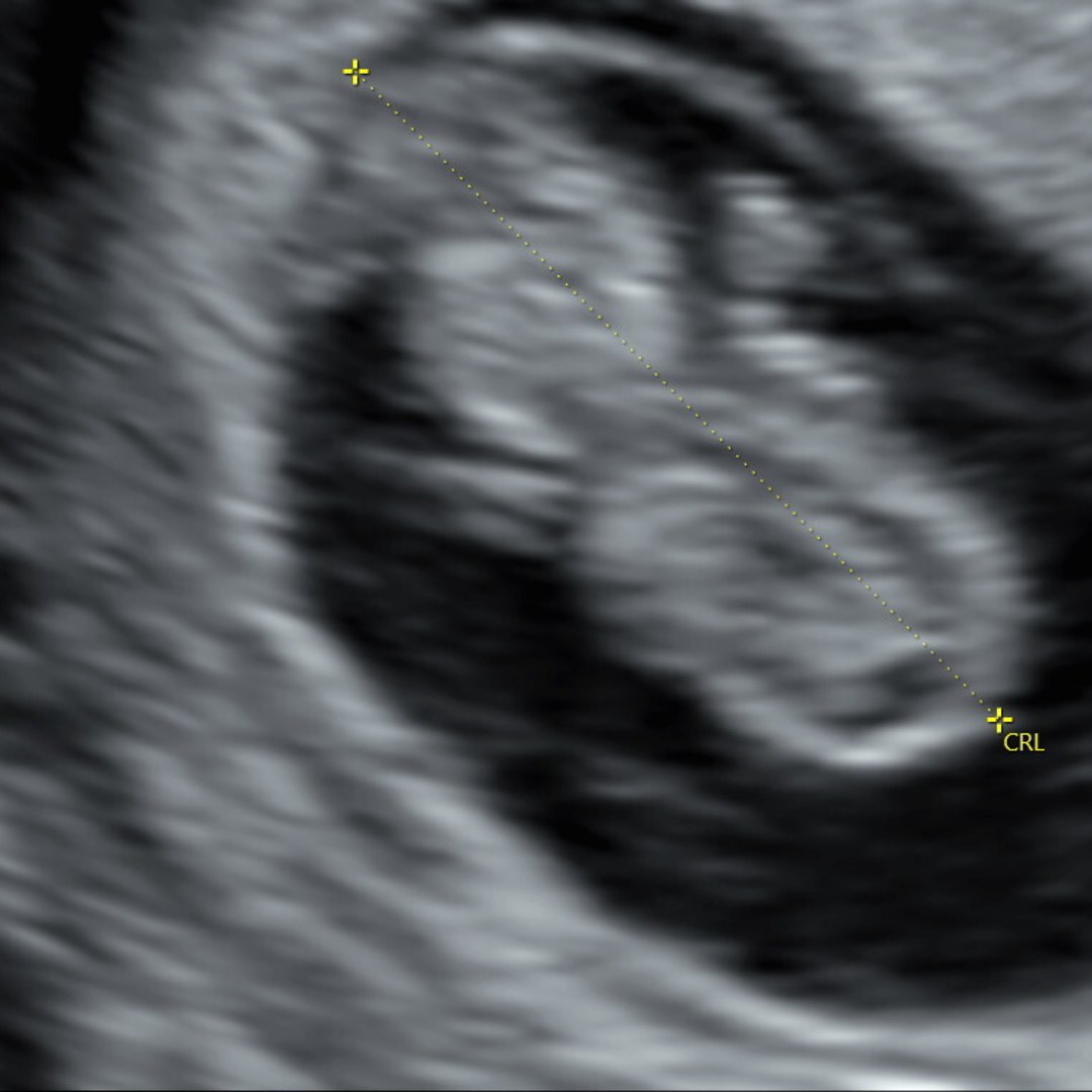 Photo shared by Becca for their Babylist baby registry.