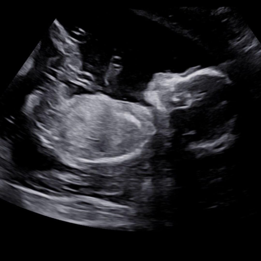 Photo shared by Macey for their Babylist baby registry.