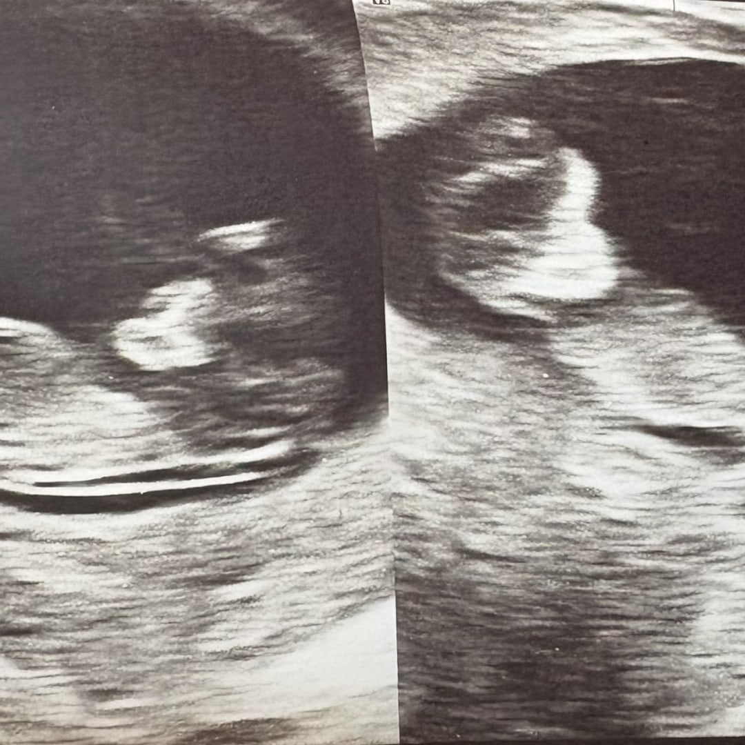Photo shared by Natalie for their Babylist baby registry.