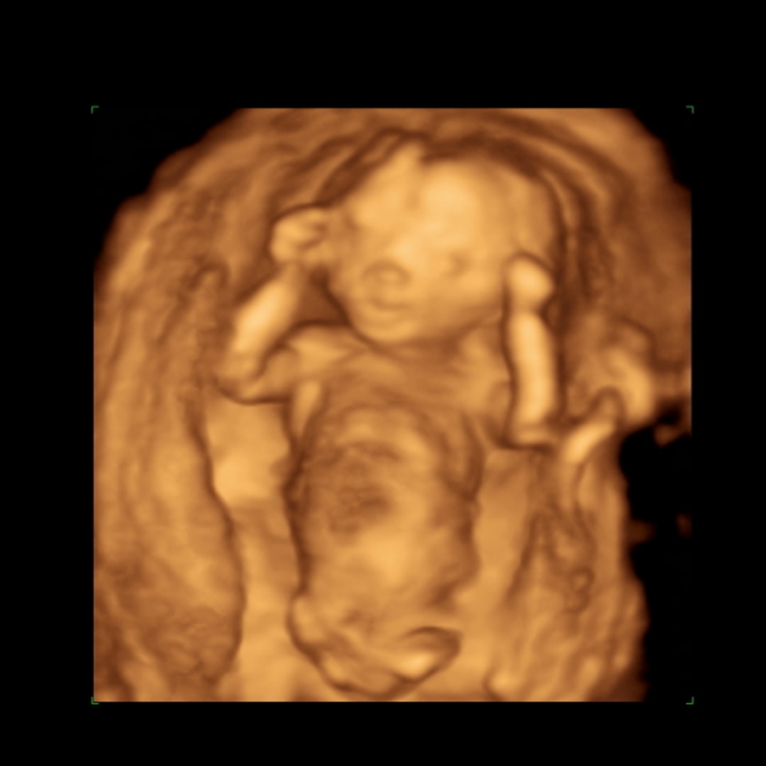 Photo shared by Destiny for their Babylist baby registry.