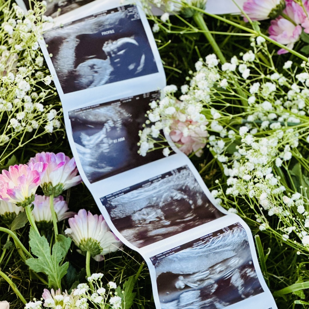 Photo shared by Cierstin for their Babylist baby registry.