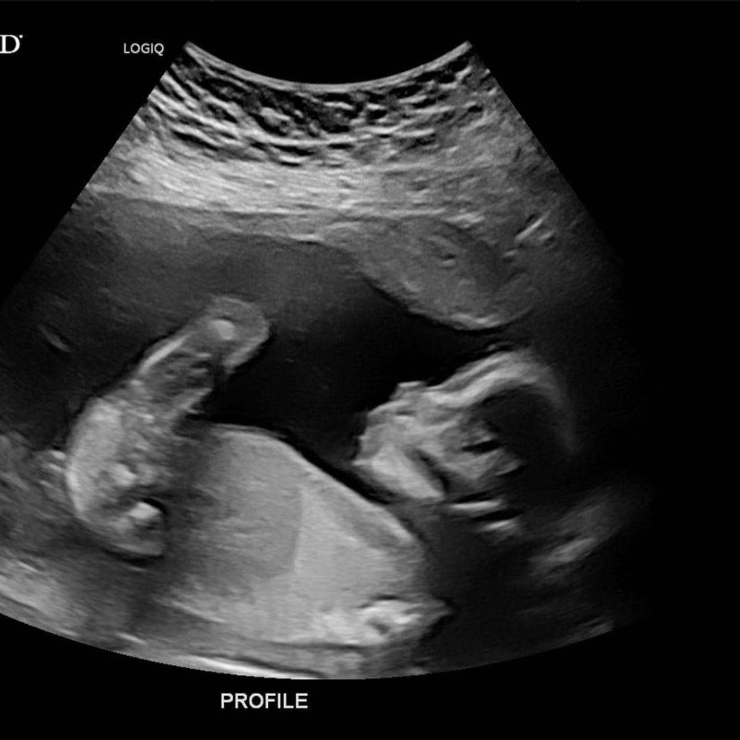 Photo shared by Hannah for their Babylist baby registry.