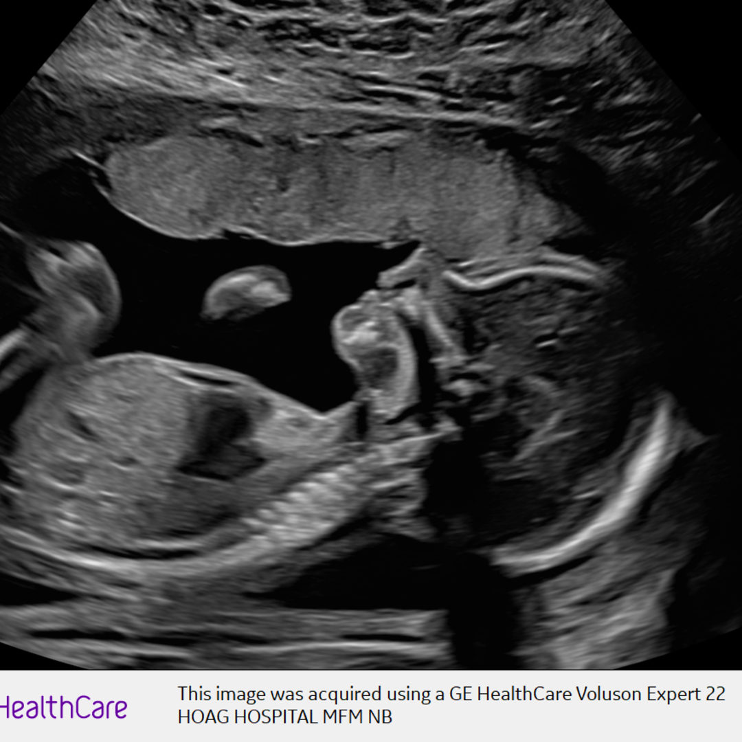 Photo shared by Ashley for their Babylist baby registry.