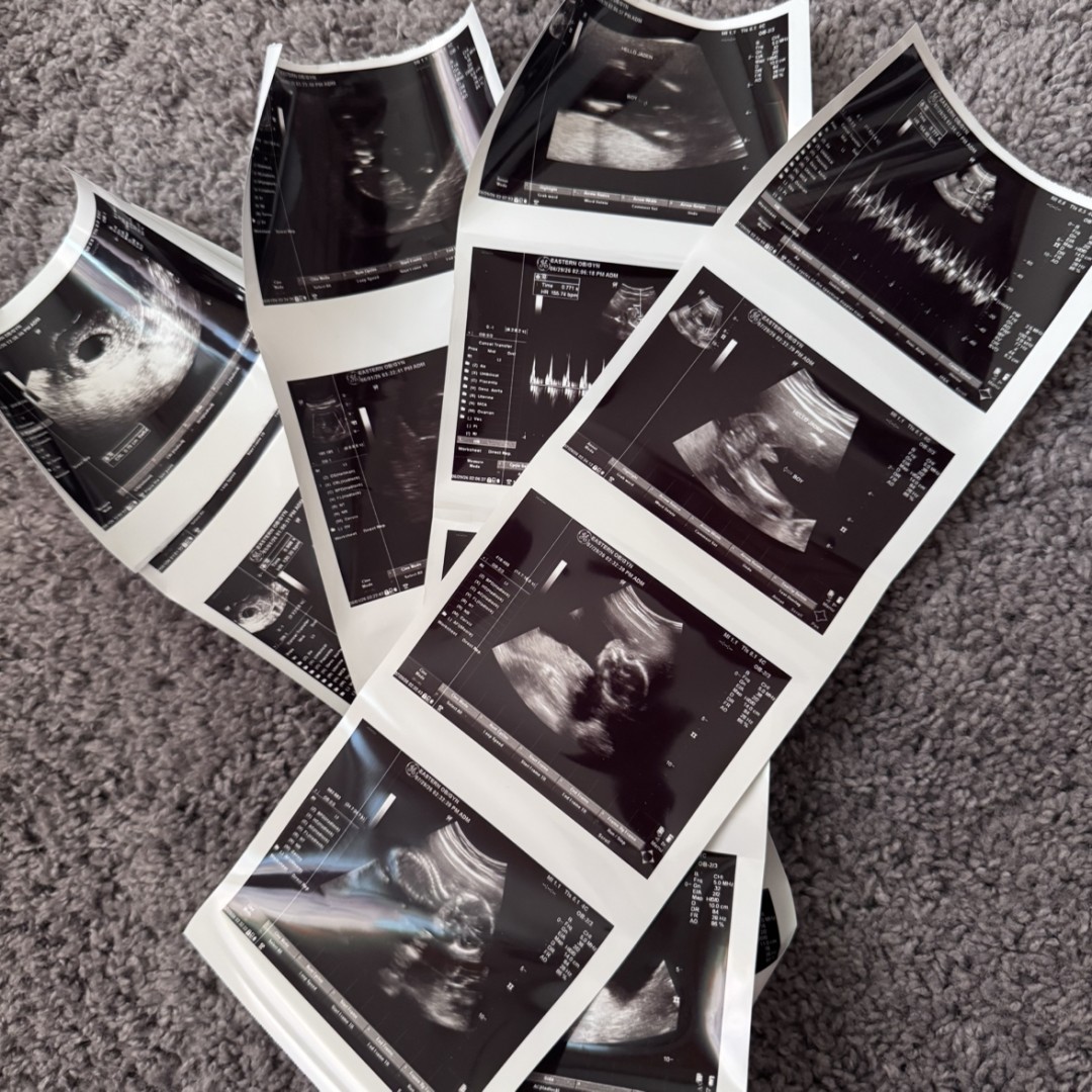 Photo shared by Chanel Love for their Babylist baby registry.