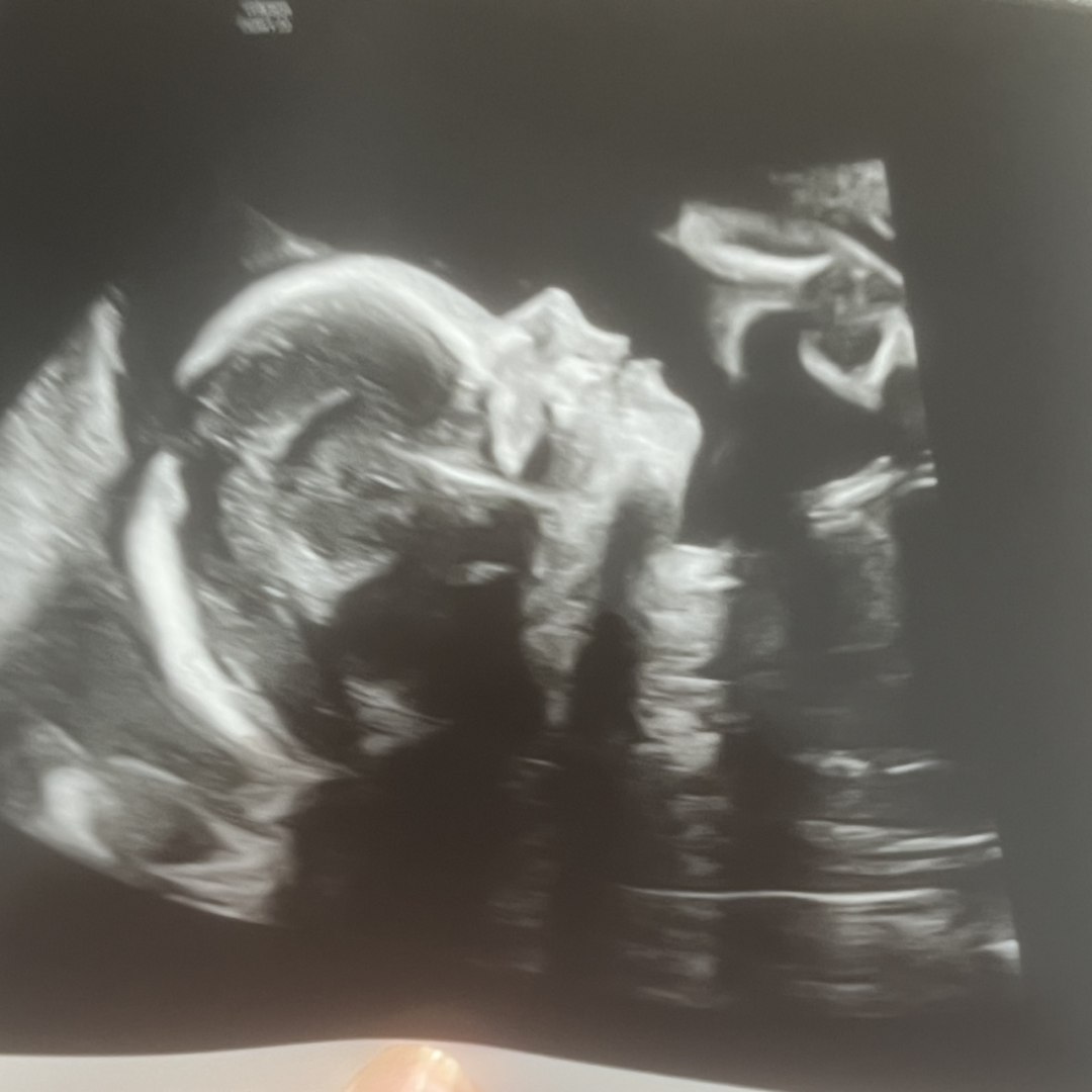 Photo shared by Courtney for their Babylist baby registry.