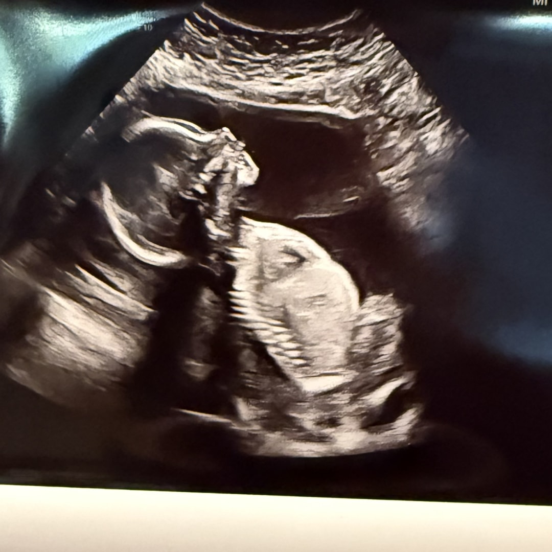 Photo shared by Christina for their Babylist baby registry.