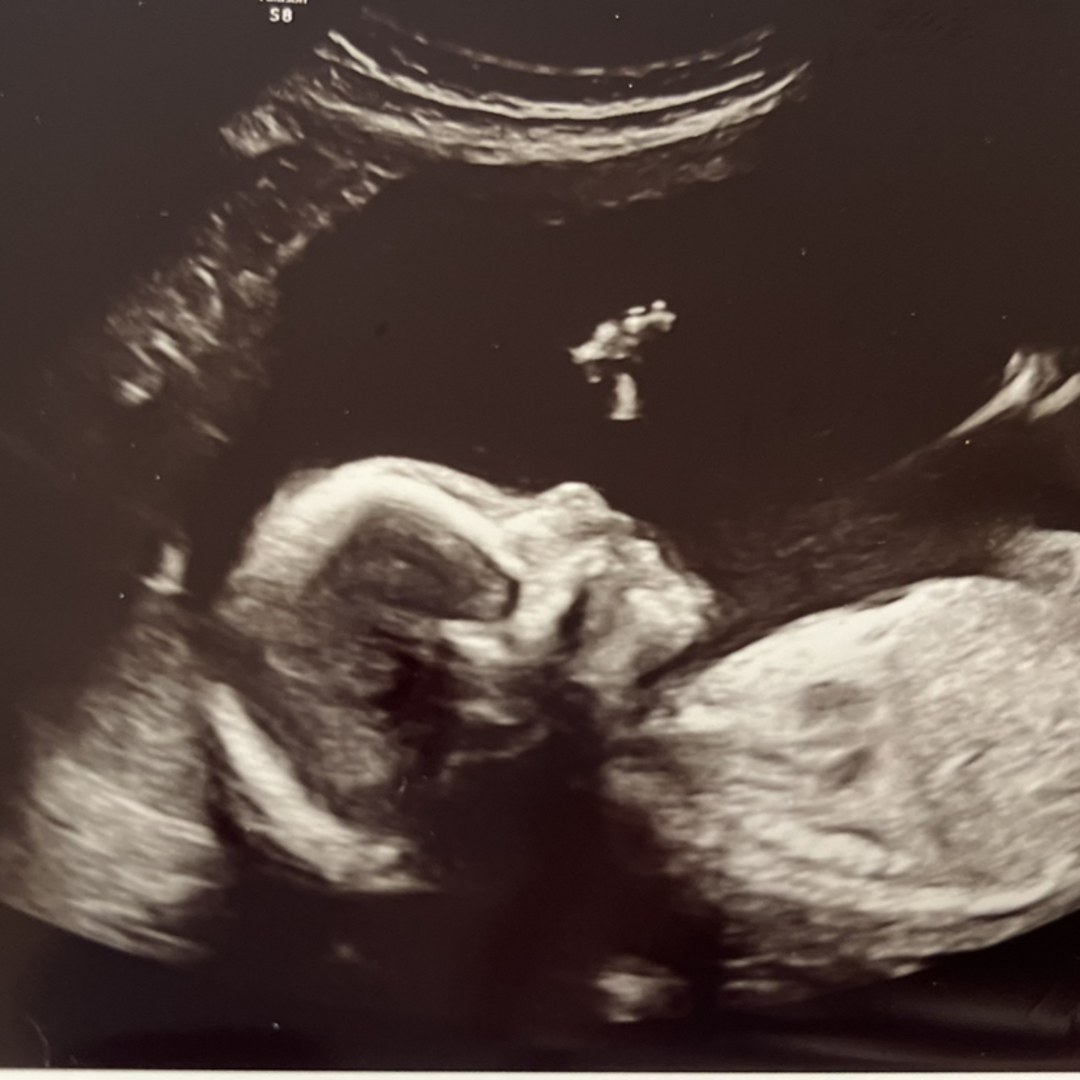 Photo shared by Alexandra for their Babylist baby registry.