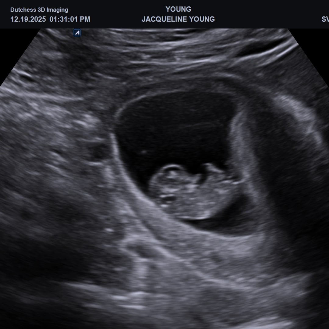 Photo shared by Jackie for their Babylist baby registry.