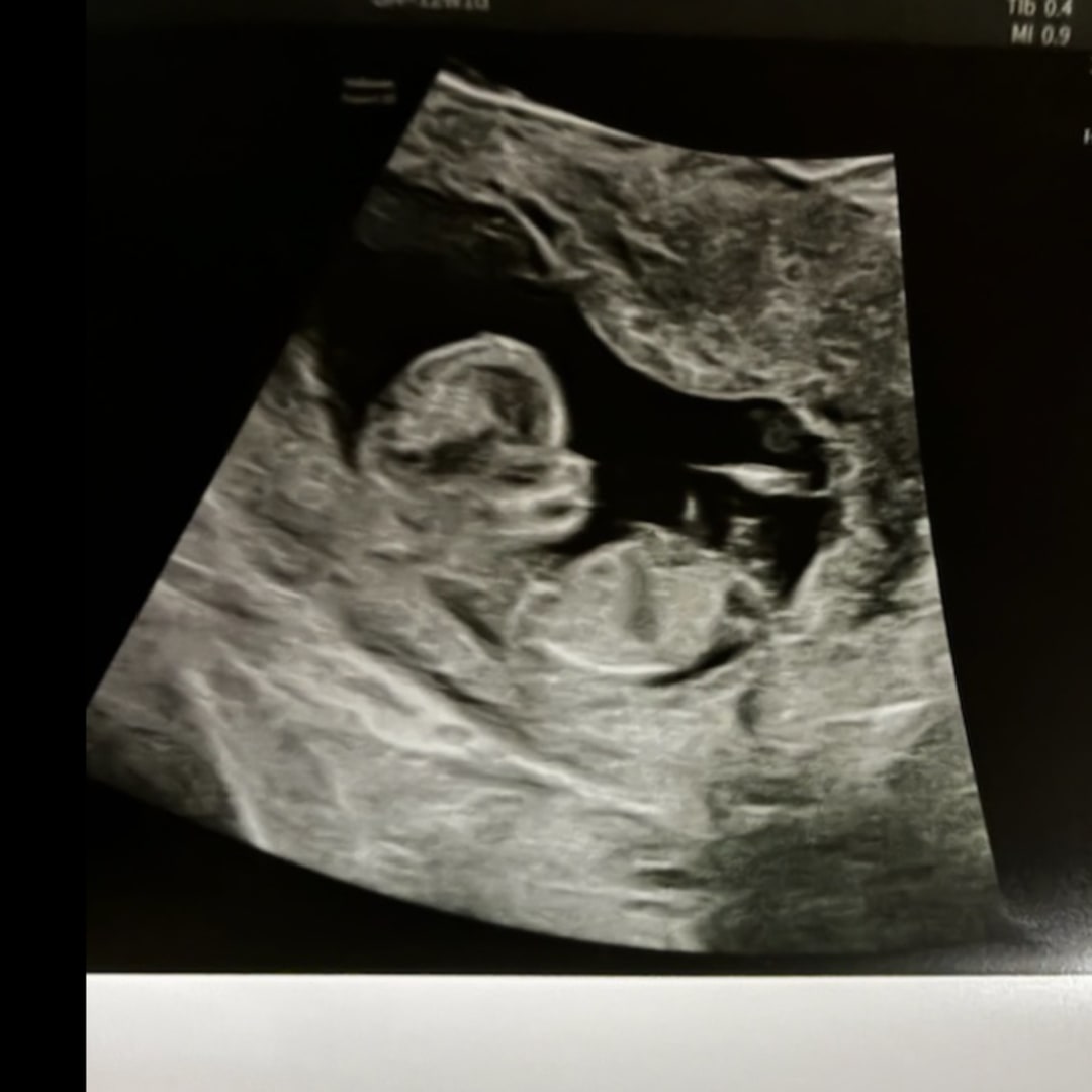 Photo shared by Megan for their Babylist baby registry.