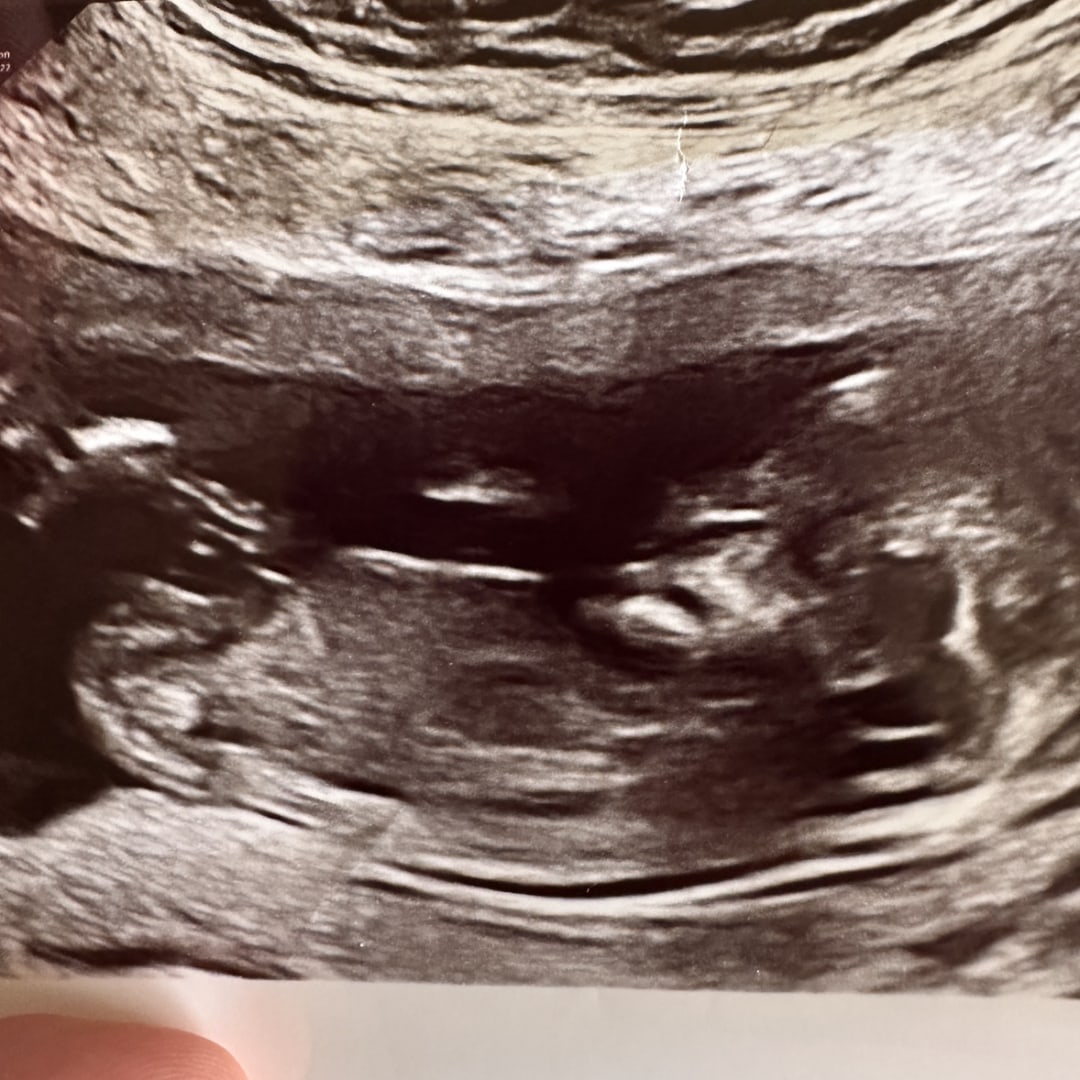 Photo shared by Brandi for their Babylist baby registry.
