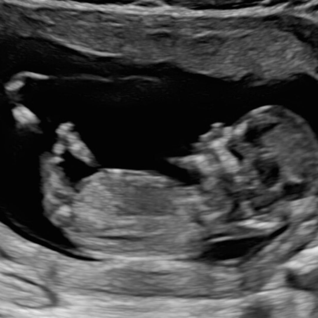 Photo shared by Rebecca for their Babylist baby registry.