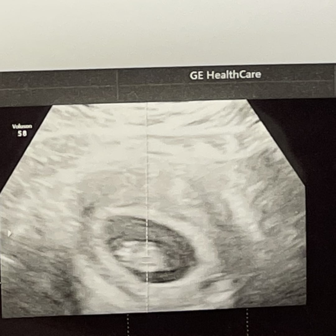 Photo shared by Erica for their Babylist baby registry.