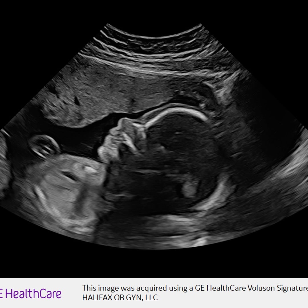 Photo shared by Kallie for their Babylist baby registry.