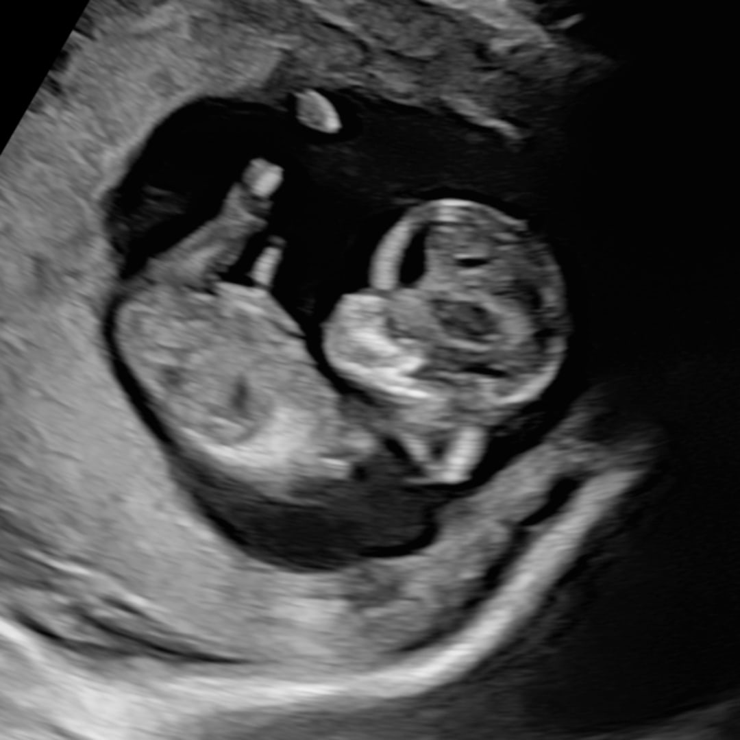 Photo shared by Riley for their Babylist baby registry.