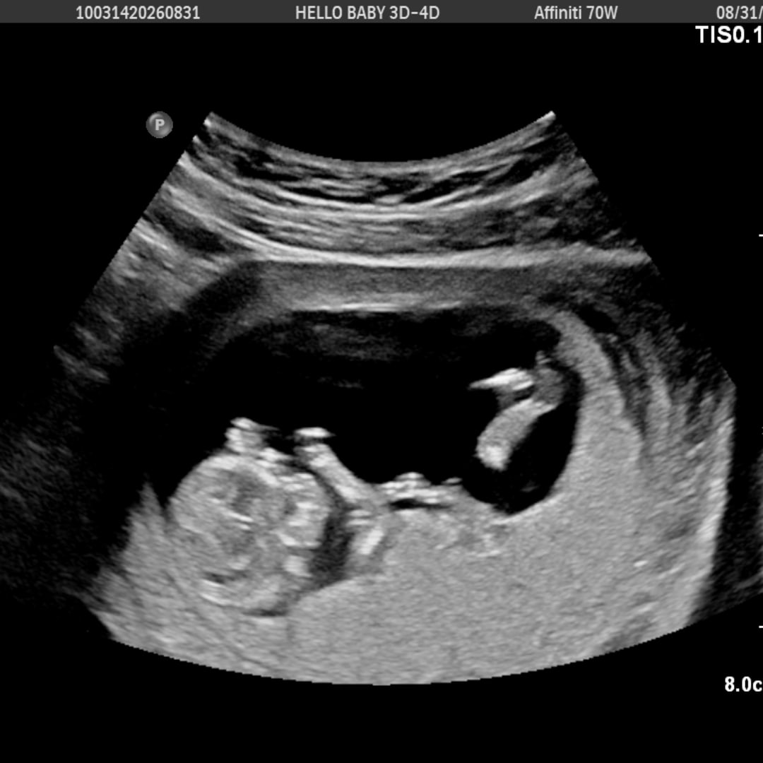 Photo shared by Abigail for their Babylist baby registry.