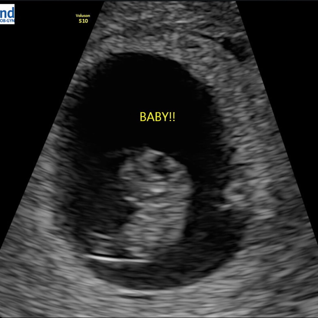 Photo shared by BreAnna for their Babylist baby registry.
