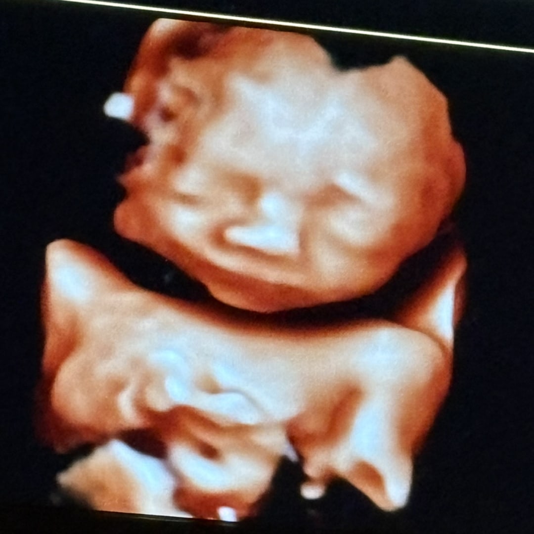 Photo shared by Jacqueline for their Babylist baby registry.