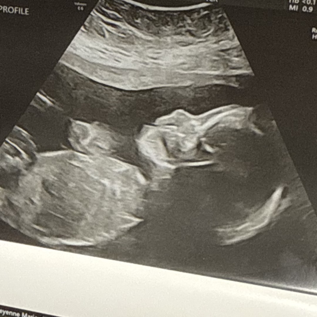 Photo shared by Cheyenne for their Babylist baby registry.