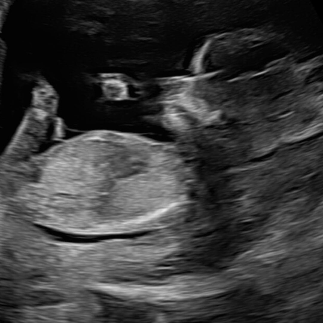 Photo shared by Mariela for their Babylist baby registry.