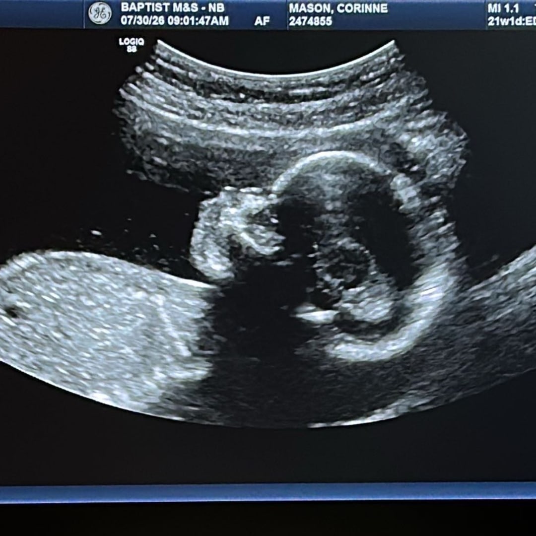 Photo shared by Corinne for their Babylist baby registry.