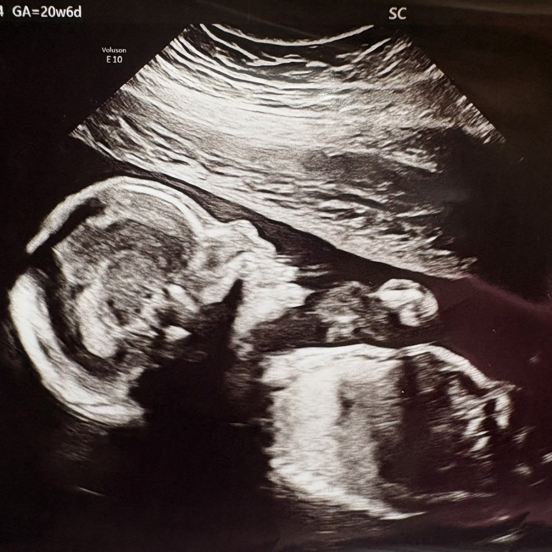 Photo shared by Nicole for their Babylist baby registry.