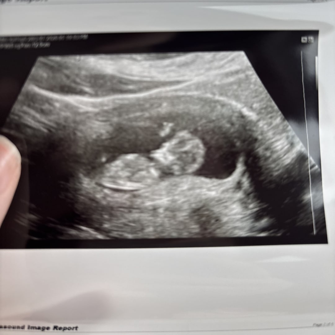 Photo shared by Brooke for their Babylist baby registry.