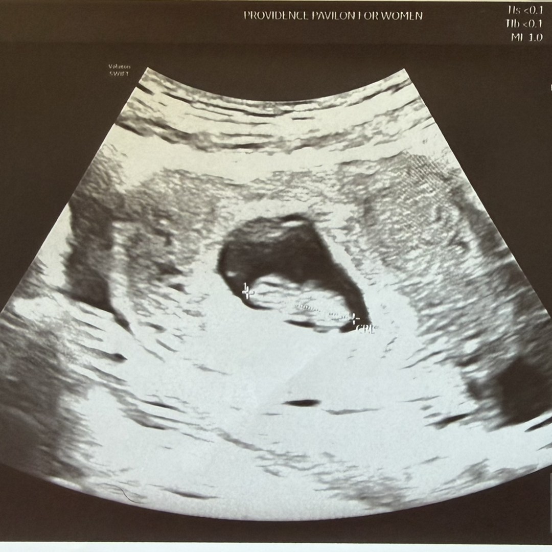 Photo shared by Jadi for their Babylist baby registry.