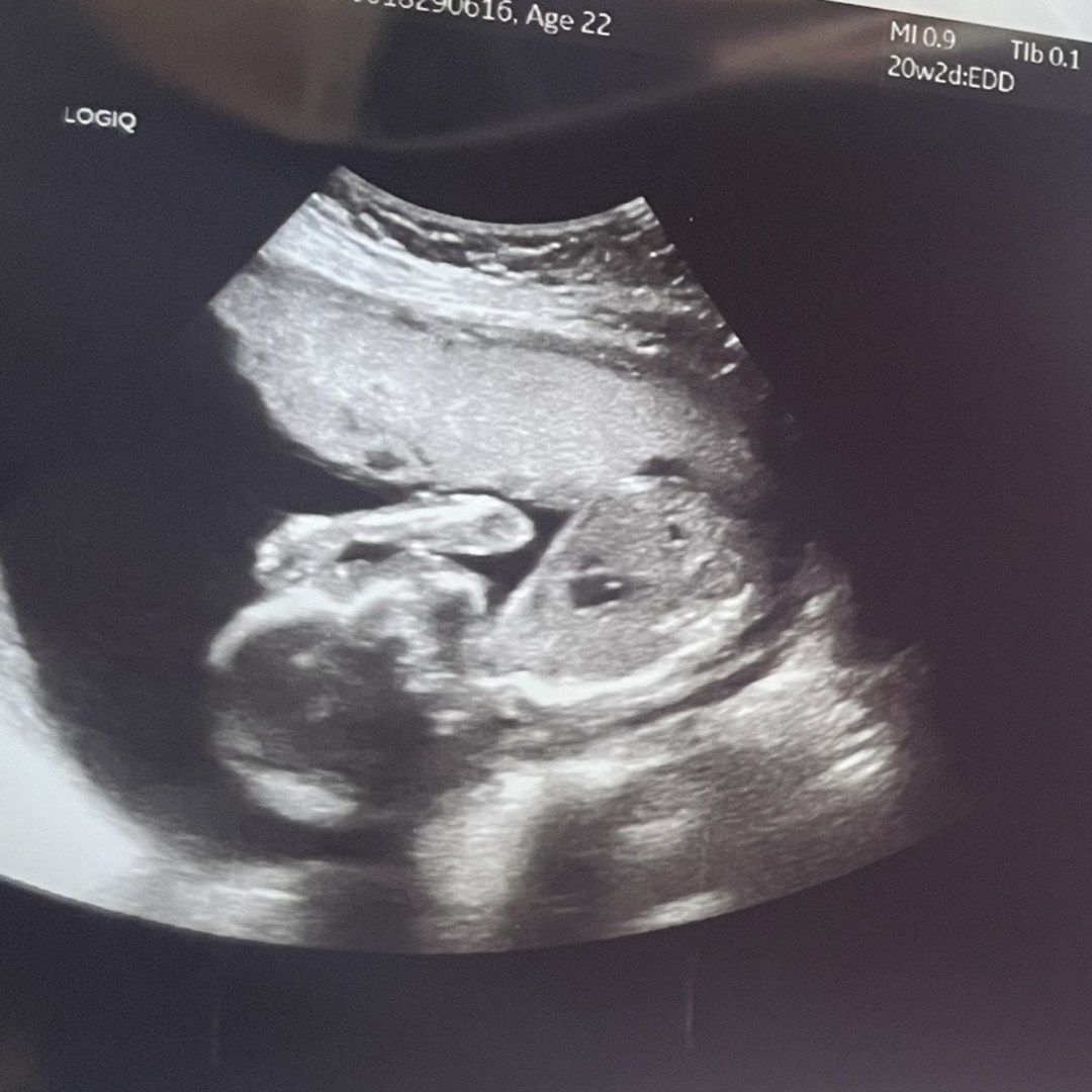 Photo shared by Maxine for their Babylist baby registry.