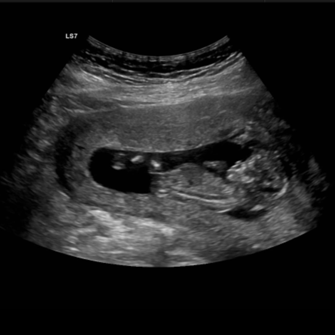 Photo shared by Christie for their Babylist baby registry.