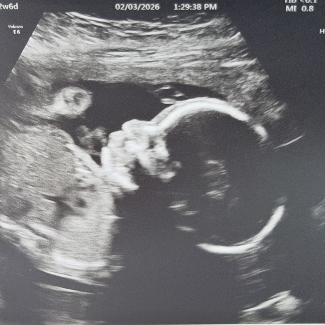 Photo shared by Mikaila for their Babylist baby registry.