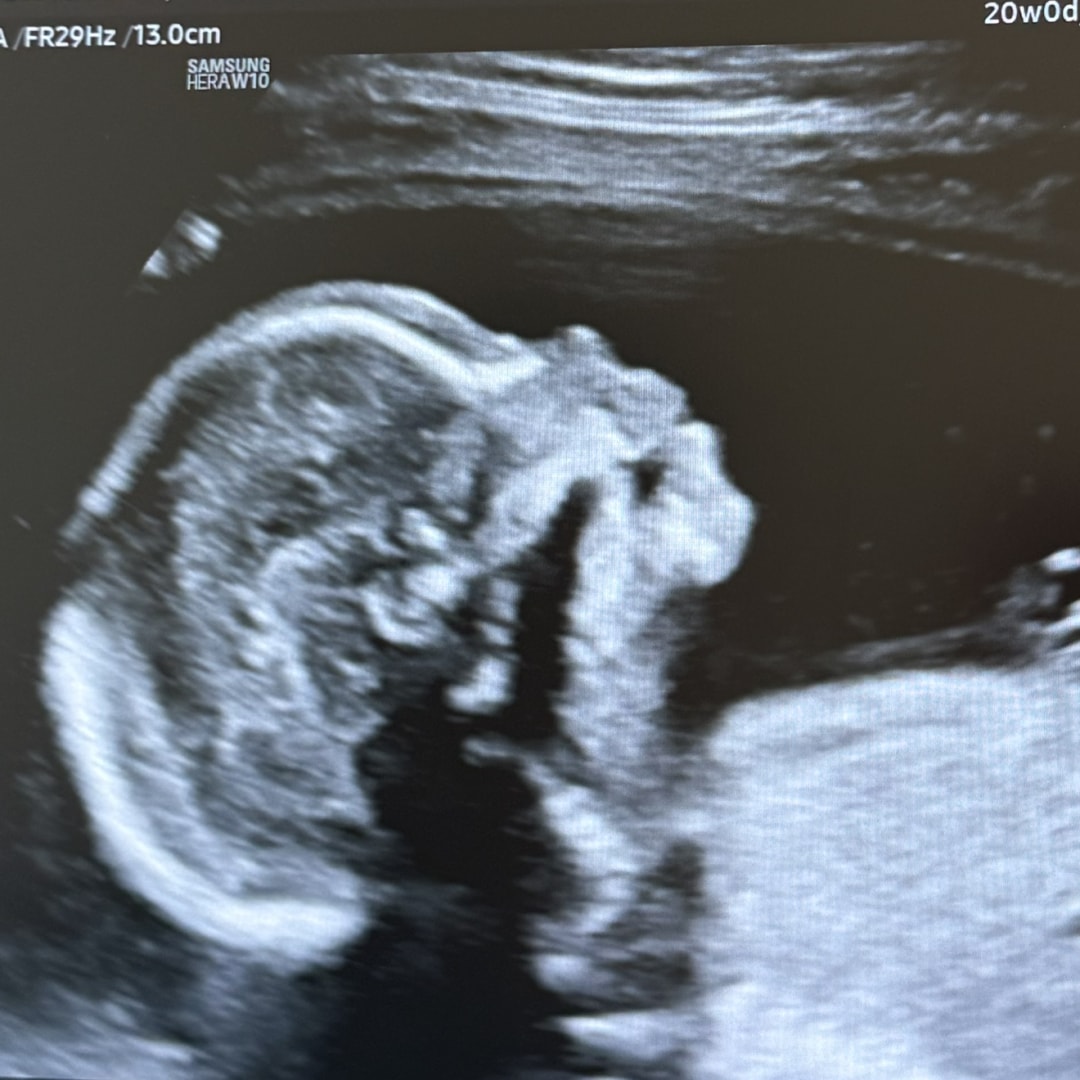 Photo shared by Sierra for their Babylist baby registry.