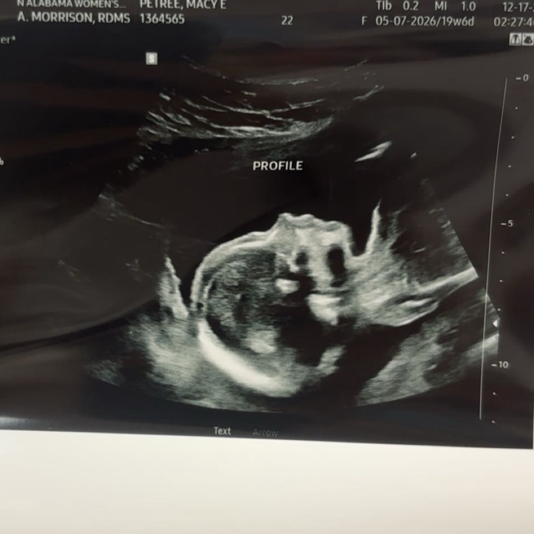 Photo shared by Macy for their Babylist baby registry.