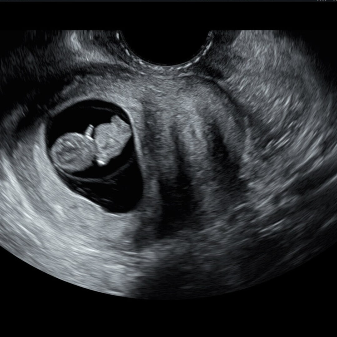 Photo shared by Zoe for their Babylist baby registry.