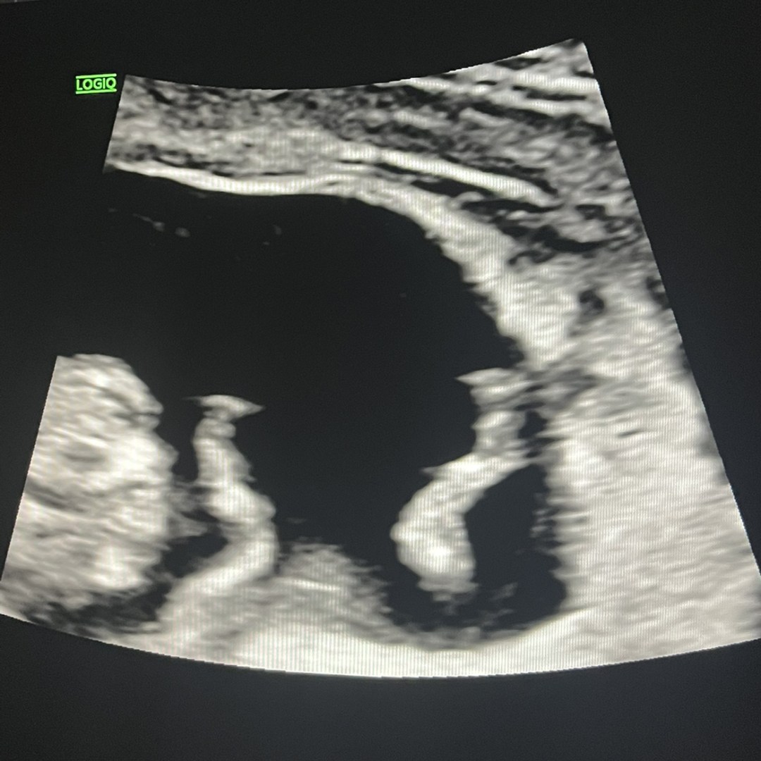 Photo shared by Lori for their Babylist baby registry.