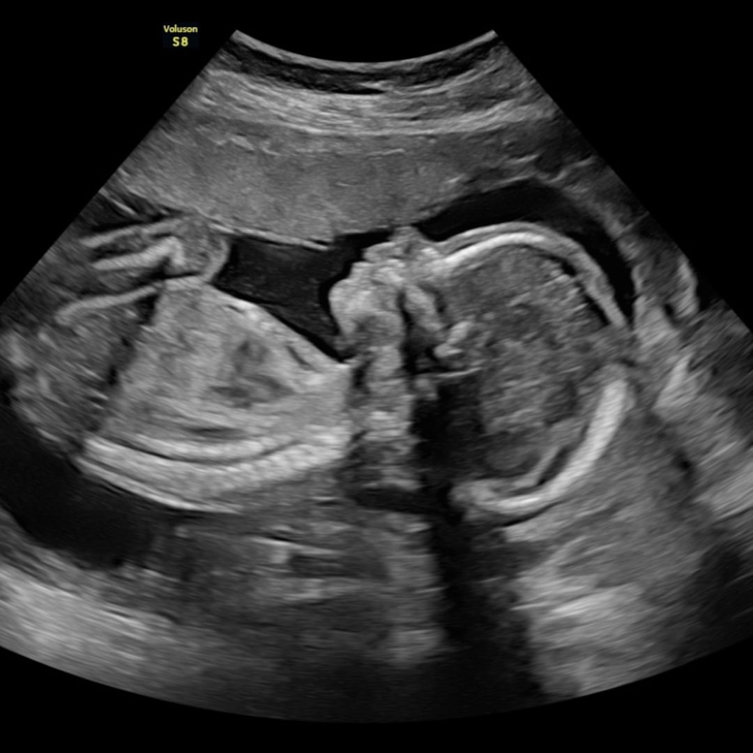 Photo shared by Anna & Jordan for their Babylist baby registry.