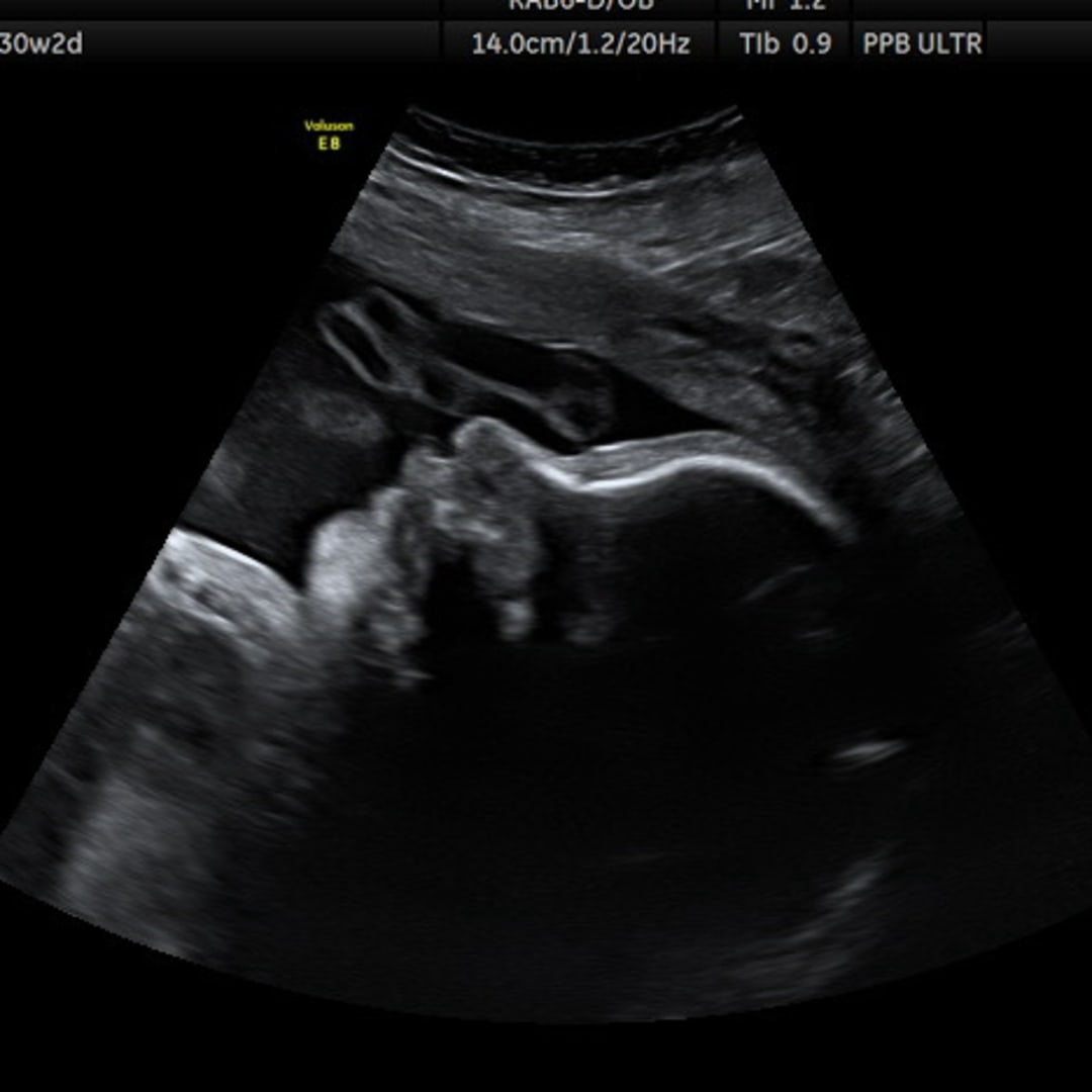 Photo shared by Tiffany for their Babylist baby registry.