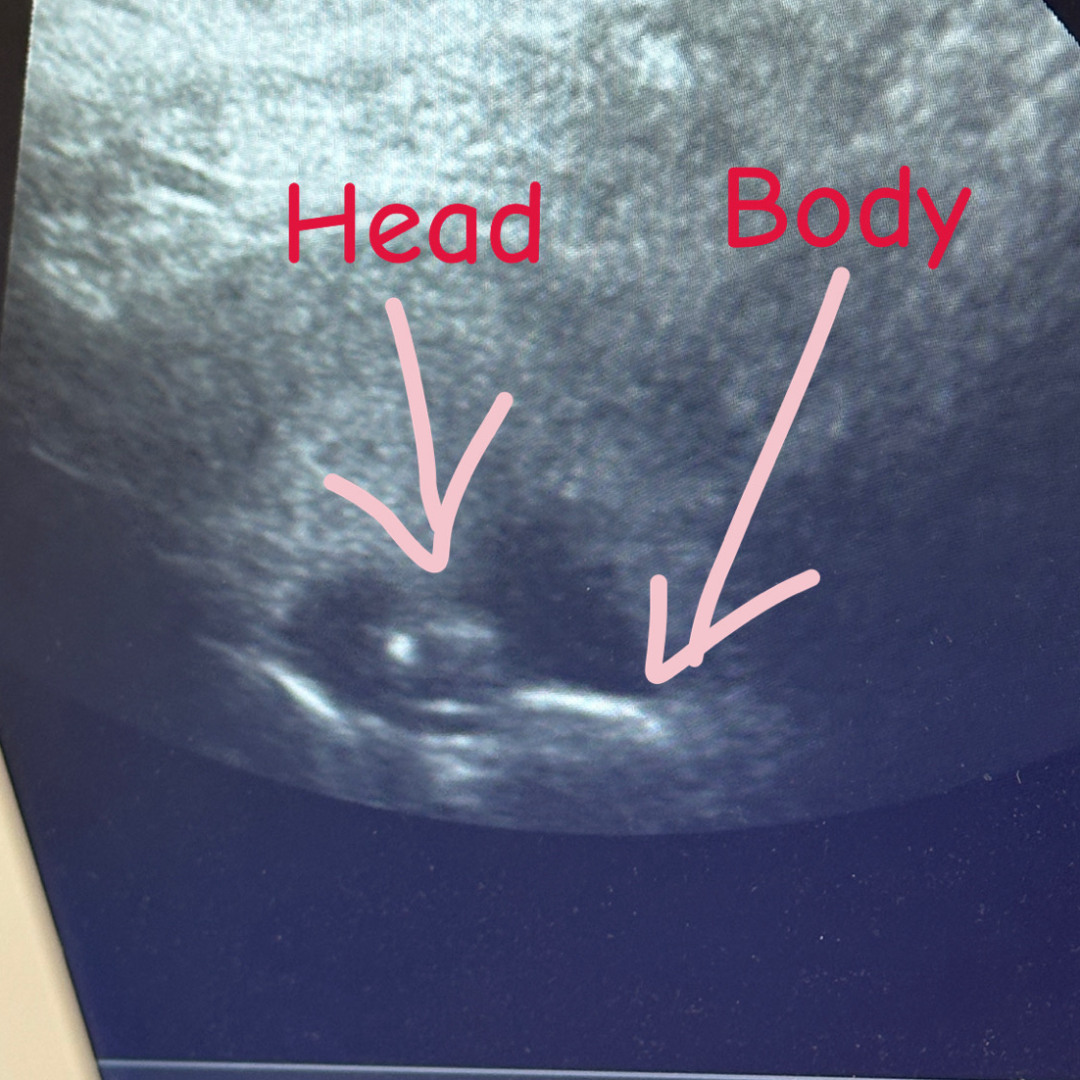 Photo shared by Emmaly for their Babylist baby registry.