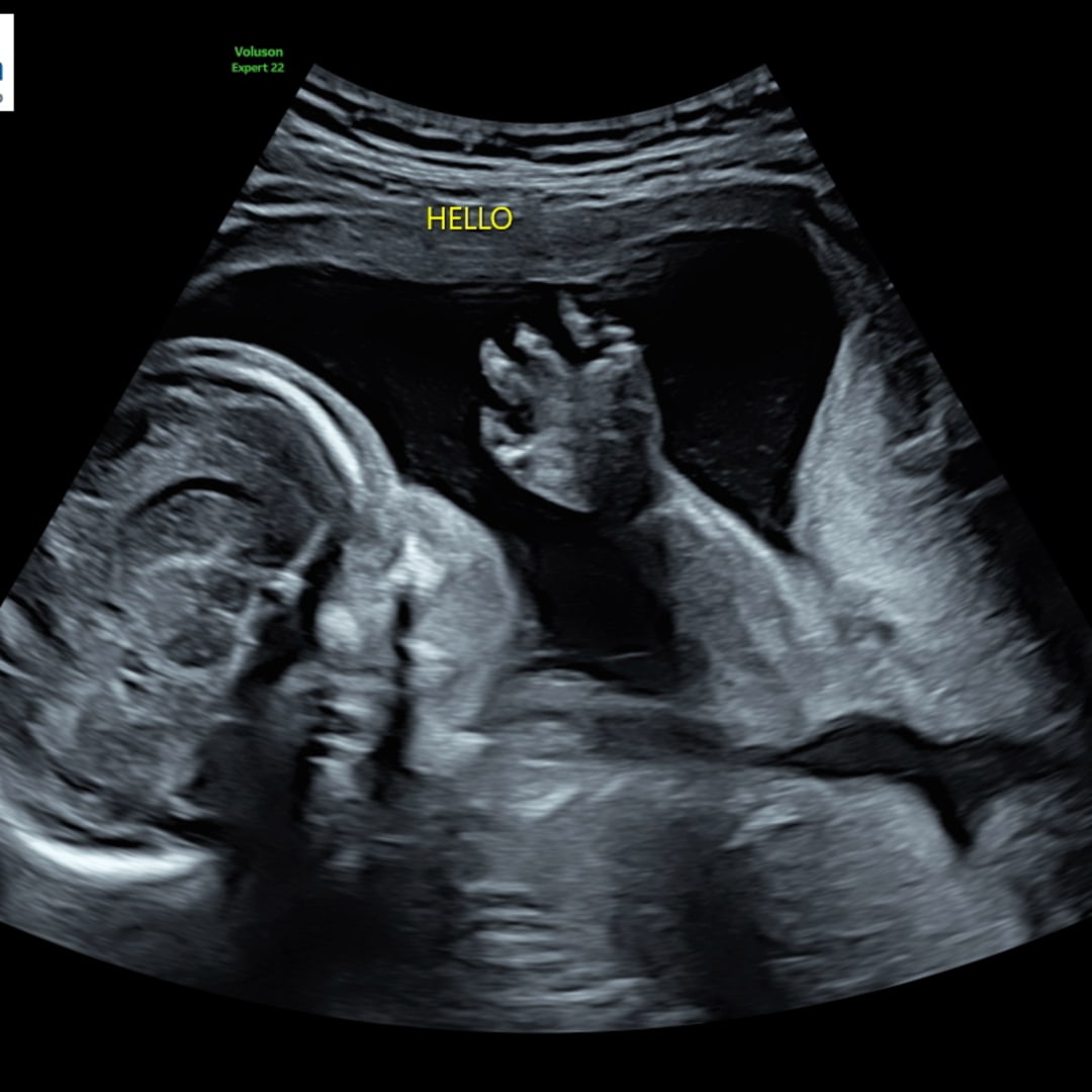 Photo shared by Sarah for their Babylist baby registry.